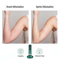 Pistolet de Massage Musculaire – Format Compact & Puissant