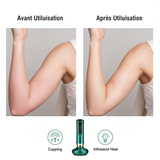 Pistolet de Massage Musculaire – Format Compact & Puissant